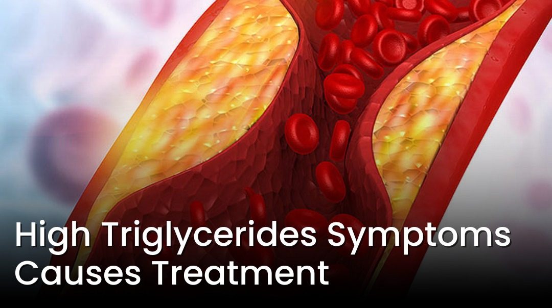 Read more about the article Triglycerides Cholesterol, Blood Pressure, and Your Heart: It’s Not What You Think.Modern Chronic Disease