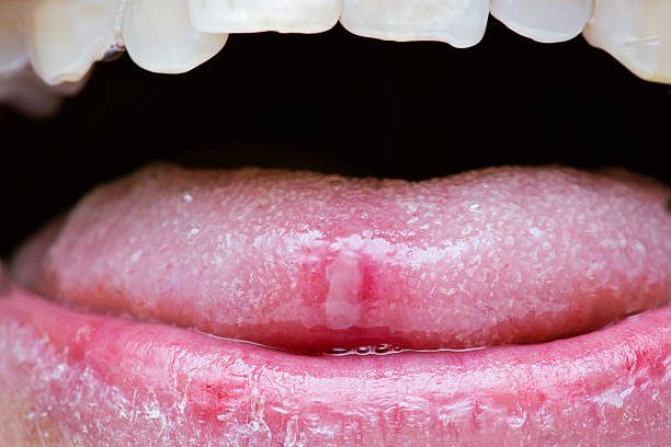 Read more about the article HUMAN TONGUE: A REFLECTION OF DIGESTIVE HEALTH