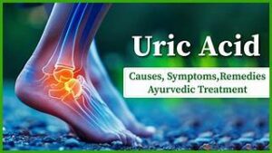 Read more about the article Uric Acid-joint pain, Arthritis,Gout.