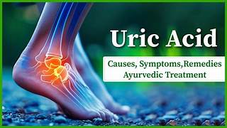 Read more about the article Uric Acid-joint pain, Arthritis,Gout.