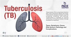Read more about the article Tuberculosis: Causes, Symptoms, Treatments, and Prevention