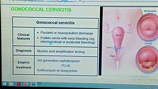 Read more about the article Title: Acute & Chronic Cervicitis in Women